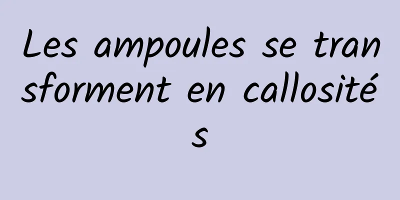 Les ampoules se transforment en callosités