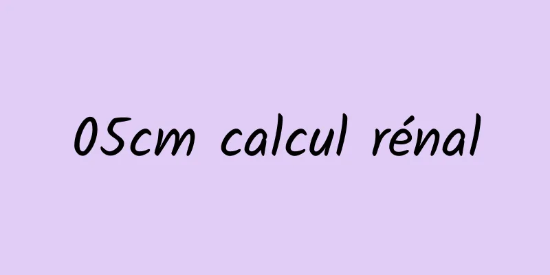 05cm calcul rénal