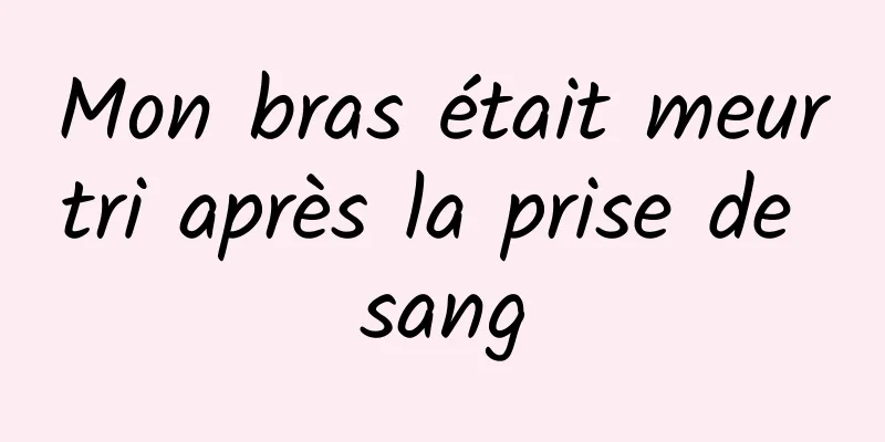 Mon bras était meurtri après la prise de sang