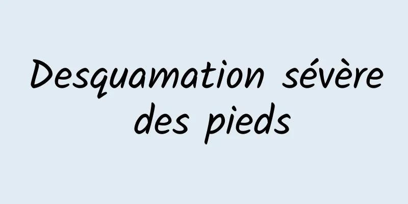 Desquamation sévère des pieds