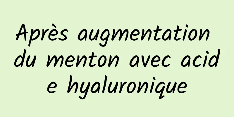 Après augmentation du menton avec acide hyaluronique