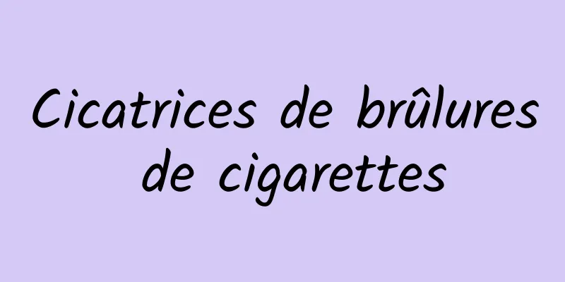 Cicatrices de brûlures de cigarettes