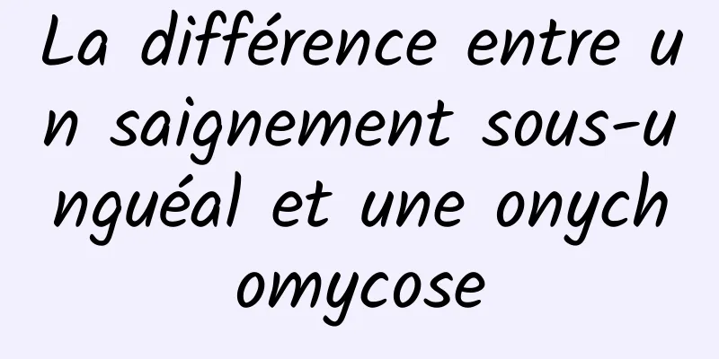 La différence entre un saignement sous-unguéal et une onychomycose