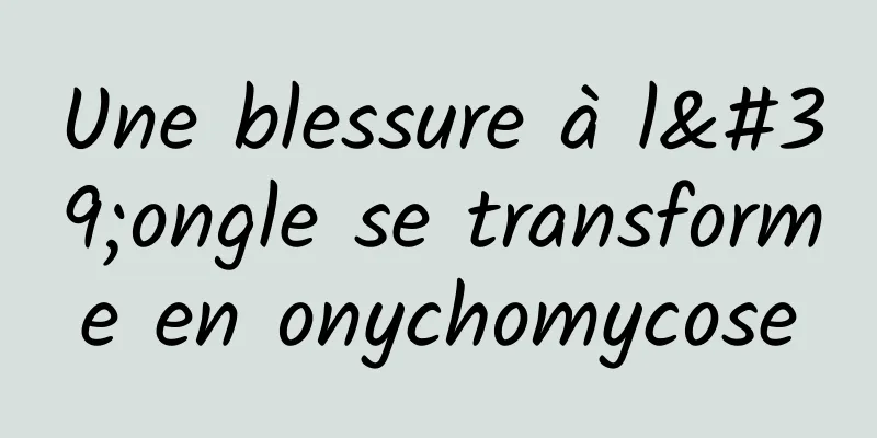 Une blessure à l'ongle se transforme en onychomycose