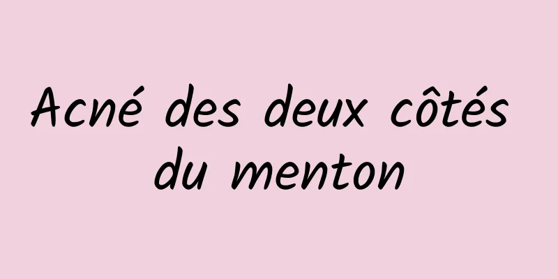 Acné des deux côtés du menton