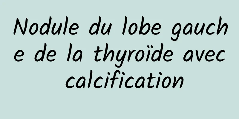 Nodule du lobe gauche de la thyroïde avec calcification