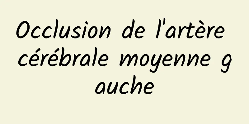 Occlusion de l'artère cérébrale moyenne gauche