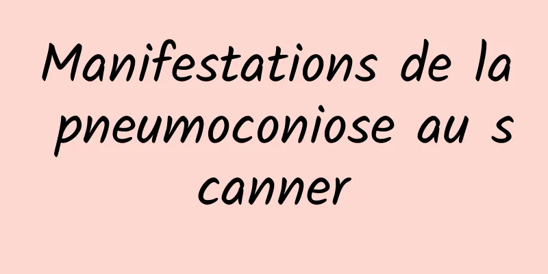 Manifestations de la pneumoconiose au scanner