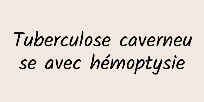Tuberculose caverneuse avec hémoptysie