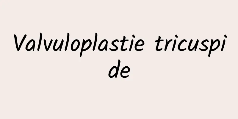 Valvuloplastie tricuspide