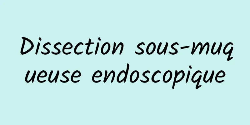 Dissection sous-muqueuse endoscopique