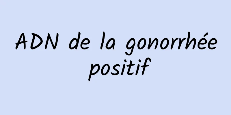ADN de la gonorrhée positif