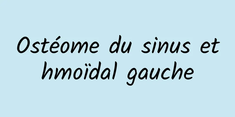Ostéome du sinus ethmoïdal gauche