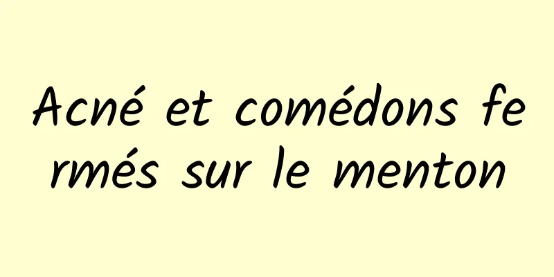 Acné et comédons fermés sur le menton