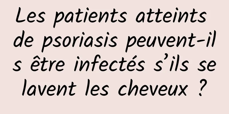 Les patients atteints de psoriasis peuvent-ils être infectés s’ils se lavent les cheveux ? 