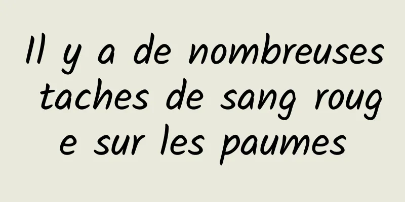 Il y a de nombreuses taches de sang rouge sur les paumes