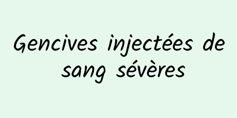 Gencives injectées de sang sévères