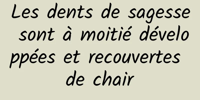 Les dents de sagesse sont à moitié développées et recouvertes de chair
