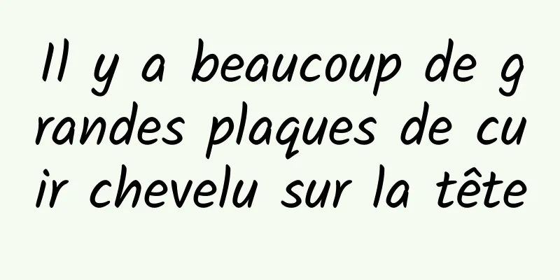 Il y a beaucoup de grandes plaques de cuir chevelu sur la tête