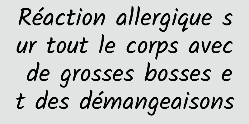 Réaction allergique sur tout le corps avec de grosses bosses et des démangeaisons