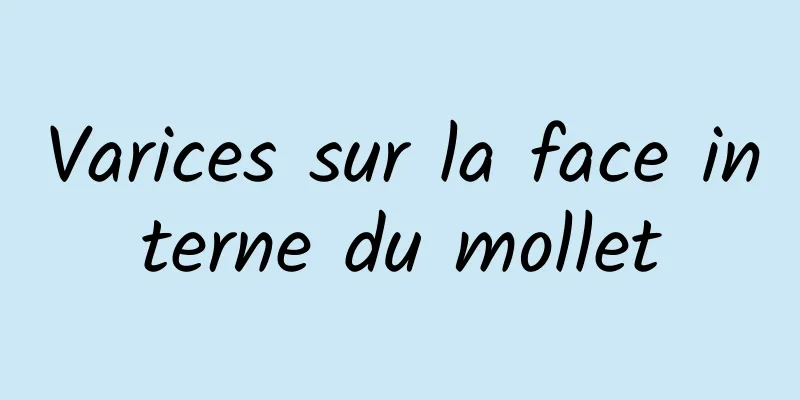Varices sur la face interne du mollet