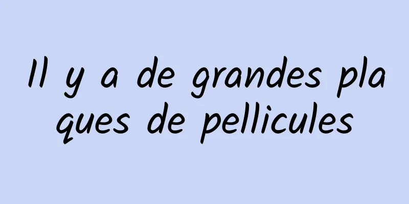 Il y a de grandes plaques de pellicules