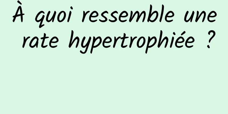 À quoi ressemble une rate hypertrophiée ? 