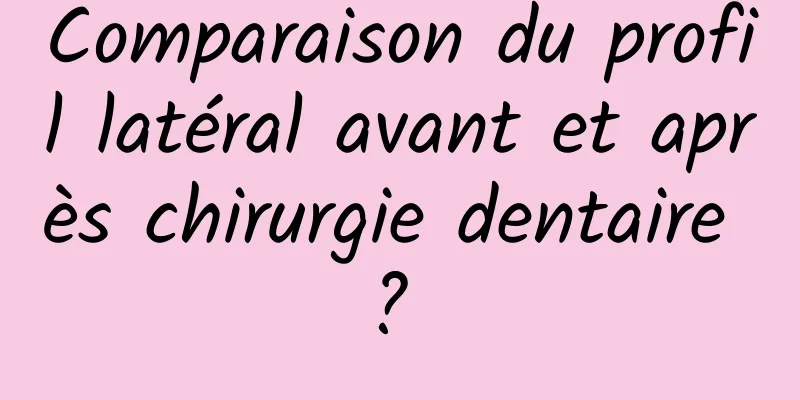 Comparaison du profil latéral avant et après chirurgie dentaire ? 