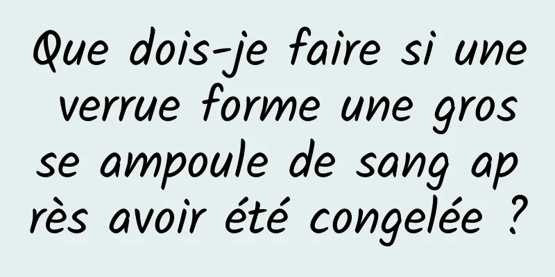 Que dois-je faire si une verrue forme une grosse ampoule de sang après avoir été congelée ?