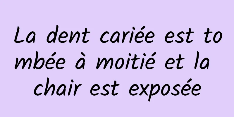 La dent cariée est tombée à moitié et la chair est exposée