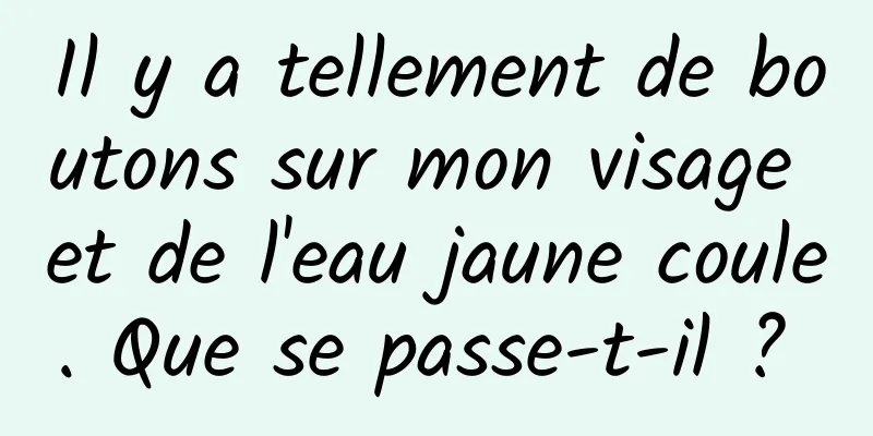 Il y a tellement de boutons sur mon visage et de l'eau jaune coule. Que se passe-t-il ? 