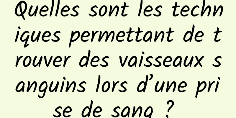 Quelles sont les techniques permettant de trouver des vaisseaux sanguins lors d’une prise de sang ? 