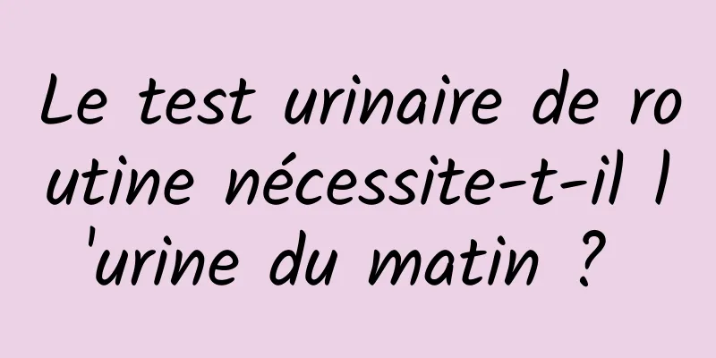 Le test urinaire de routine nécessite-t-il l'urine du matin ? 