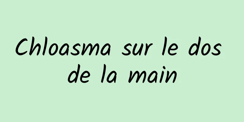 Chloasma sur le dos de la main