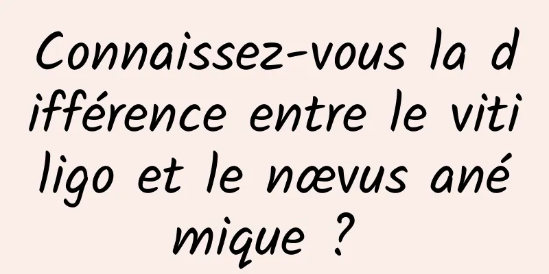 Connaissez-vous la différence entre le vitiligo et le nævus anémique ? 