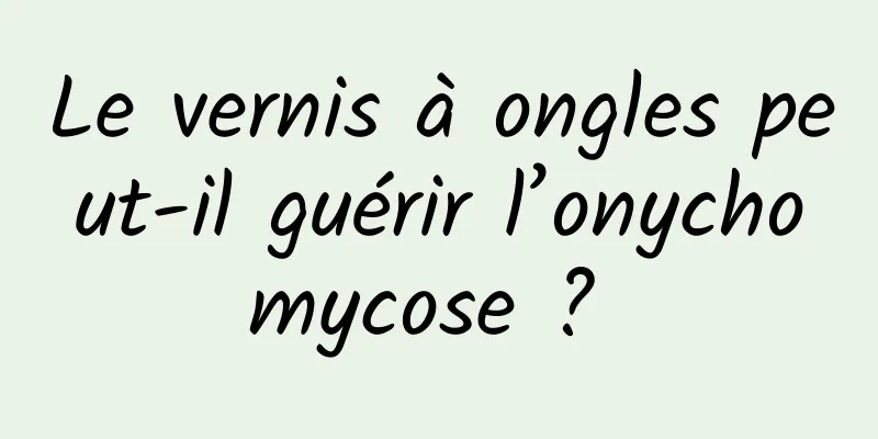 Le vernis à ongles peut-il guérir l’onychomycose ? 