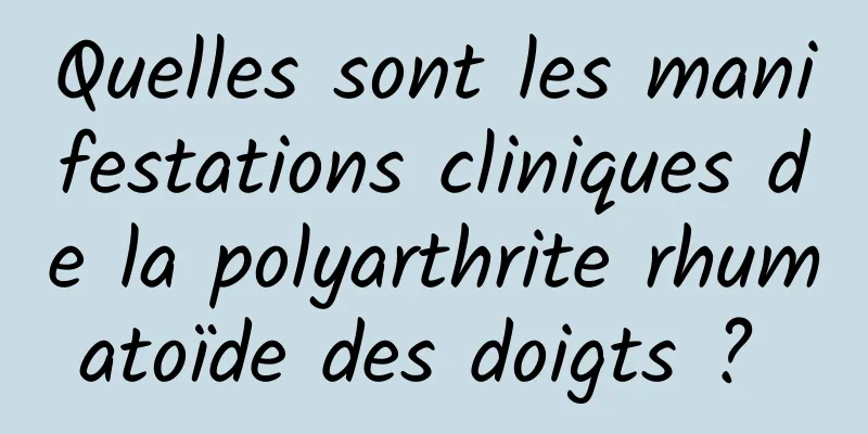 Quelles sont les manifestations cliniques de la polyarthrite rhumatoïde des doigts ? 
