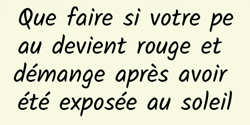 Que faire si votre peau devient rouge et démange après avoir été exposée au soleil