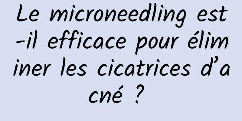 Le microneedling est-il efficace pour éliminer les cicatrices d’acné ? 