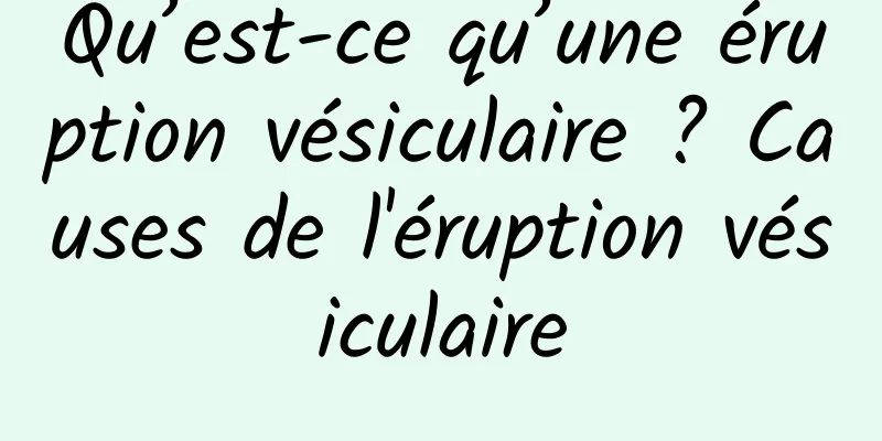 Qu’est-ce qu’une éruption vésiculaire ? Causes de l'éruption vésiculaire