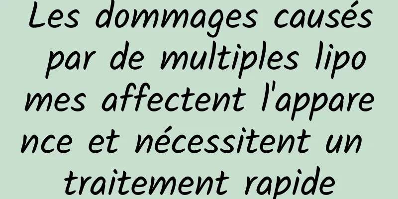 Les dommages causés par de multiples lipomes affectent l'apparence et nécessitent un traitement rapide