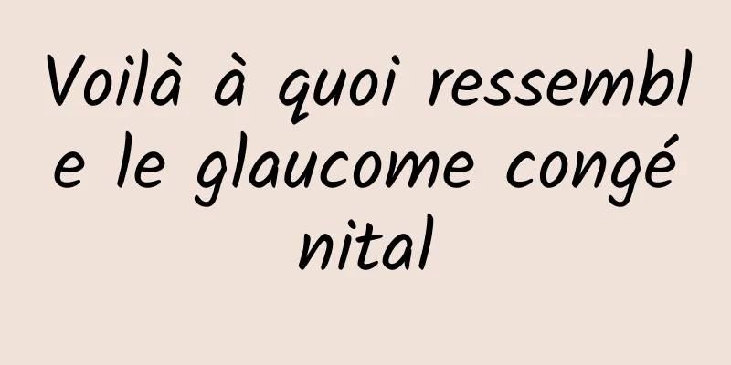 Voilà à quoi ressemble le glaucome congénital