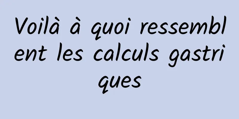 Voilà à quoi ressemblent les calculs gastriques