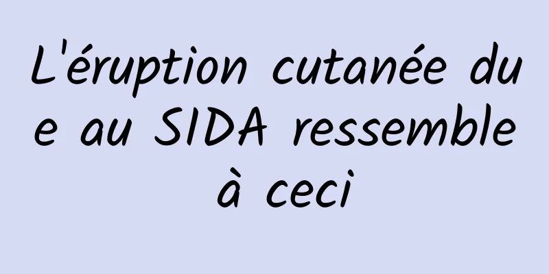 L'éruption cutanée due au SIDA ressemble à ceci