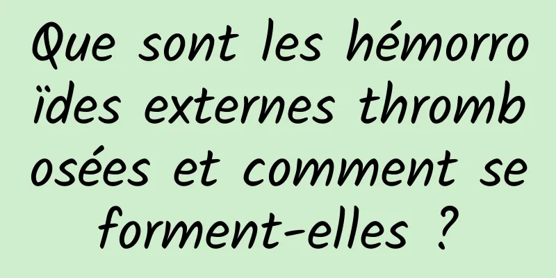 Que sont les hémorroïdes externes thrombosées et comment se forment-elles ? 