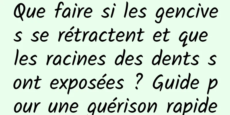 Que faire si les gencives se rétractent et que les racines des dents sont exposées ? Guide pour une guérison rapide