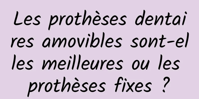 Les prothèses dentaires amovibles sont-elles meilleures ou les prothèses fixes ?