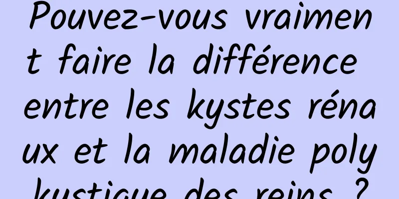 Pouvez-vous vraiment faire la différence entre les kystes rénaux et la maladie polykystique des reins ?