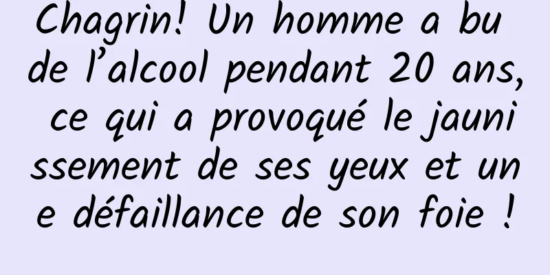 Chagrin! Un homme a bu de l’alcool pendant 20 ans, ce qui a provoqué le jaunissement de ses yeux et une défaillance de son foie !