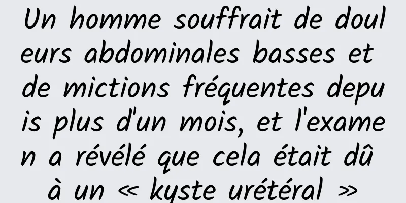 Un homme souffrait de douleurs abdominales basses et de mictions fréquentes depuis plus d'un mois, et l'examen a révélé que cela était dû à un « kyste urétéral »